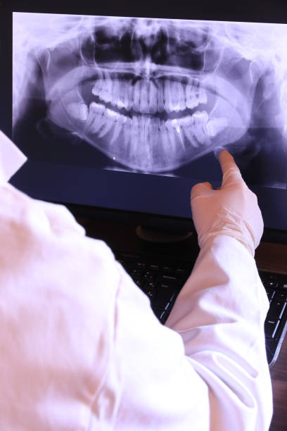 Best Emergency TMJ Treatment in Cloverdale, IN